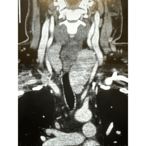 thyroid radiograph